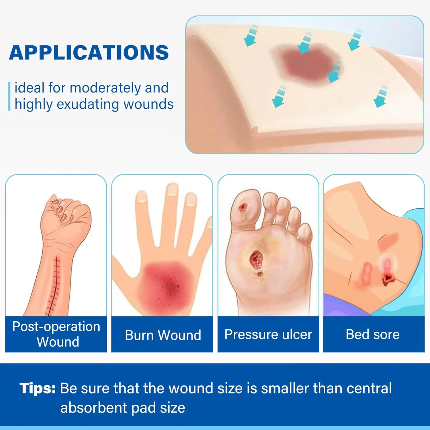 LotFancy Silicone Foam Dressing, 6"x 6" (4.3"x 4.3" Pad), 5 Count, Sterile Wound Dressing with Border, Bed Sores, Pressure Ulcers, Emergency Wound Care Bandages, Highly Absorbent, Waterproof